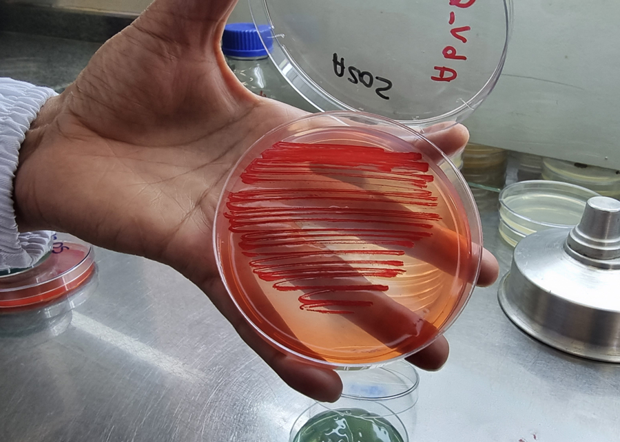 Produtividade em lavouras pode aumentar com bactérias 